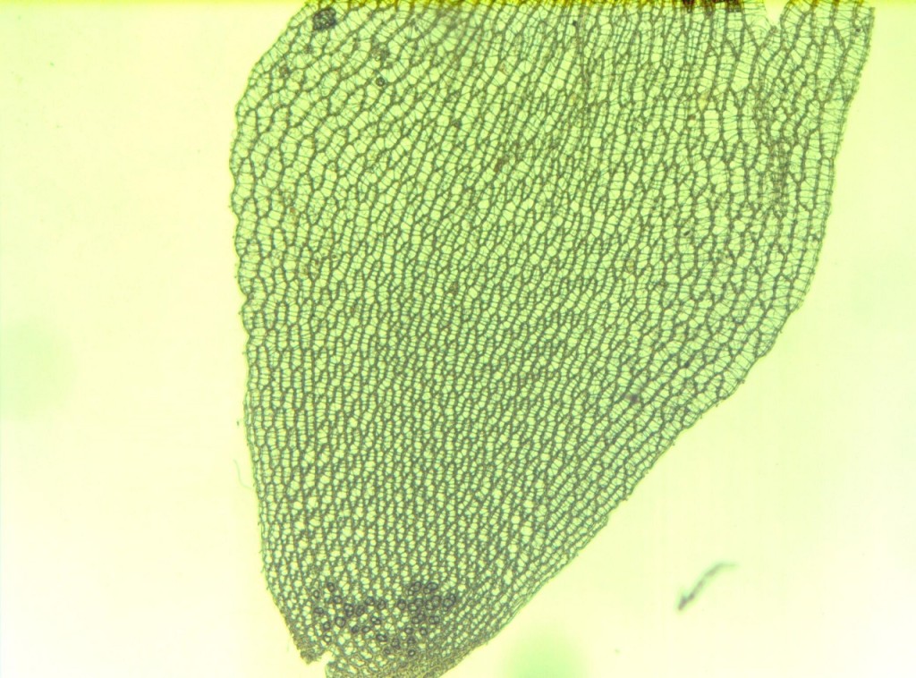 Fot. 3 Zdjęcie mikroskopowe powierzchni liścia torfowca z widocznym dużymi komórkami wodonośnymi.